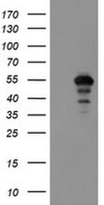 MEIS3 Antibody in Western Blot (WB)