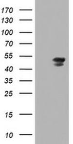 MEIS3 Antibody in Western Blot (WB)
