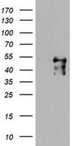 MEIS3 Antibody in Western Blot (WB)