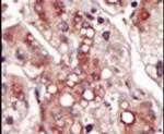 MEK2 Antibody in Immunohistochemistry (IHC)