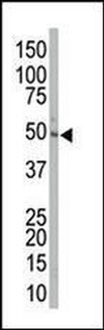 MEK2 Antibody in Western Blot (WB)