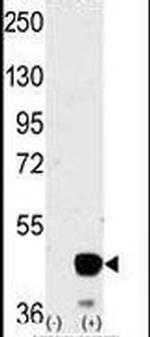 MEK2 Antibody in Western Blot (WB)