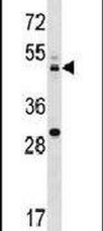 MEK2 Antibody in Western Blot (WB)