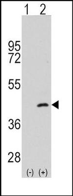 MAP2K4 Antibody in Western Blot (WB)