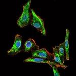 MELK Antibody in Immunocytochemistry (ICC/IF)