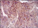 MELK Antibody in Immunohistochemistry (Paraffin) (IHC (P))