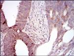 MELK Antibody in Immunohistochemistry (Paraffin) (IHC (P))