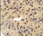 Menin Antibody in Immunohistochemistry (IHC)