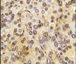 Menin Antibody in Immunohistochemistry (IHC)