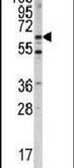 Menin Antibody in Western Blot (WB)