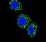 Menin Antibody in Immunocytochemistry (ICC/IF)