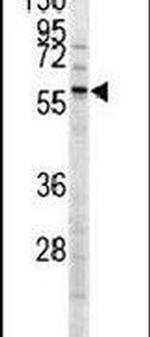 Menin Antibody in Western Blot (WB)