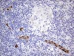 MEOX1 Antibody in Immunohistochemistry (Paraffin) (IHC (P))