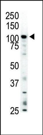 MERTK Antibody in Western Blot (WB)