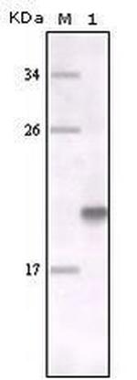 MERTK Antibody in Western Blot (WB)