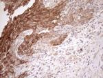 MET Antibody in Immunohistochemistry (Paraffin) (IHC (P))