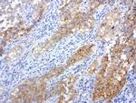 MET Antibody in Immunohistochemistry (Paraffin) (IHC (P))