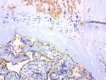 MET Antibody in Immunohistochemistry (Paraffin) (IHC (P))