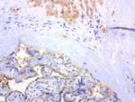 MET Antibody in Immunohistochemistry (Paraffin) (IHC (P))