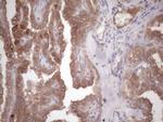 MET Antibody in Immunohistochemistry (Paraffin) (IHC (P))