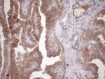 MET Antibody in Immunohistochemistry (Paraffin) (IHC (P))