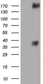 MET Antibody in Western Blot (WB)