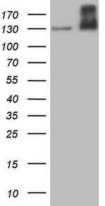MET Antibody in Western Blot (WB)