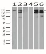 MET Antibody in Western Blot (WB)