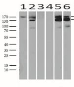MET Antibody in Western Blot (WB)