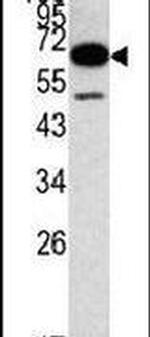 METAP2 Antibody in Western Blot (WB)