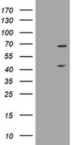 METT10D Antibody in Western Blot (WB)