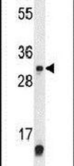 METTL1 Antibody in Western Blot (WB)