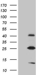 METTL7A Antibody in Western Blot (WB)