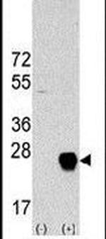 METTL7A Antibody in Western Blot (WB)