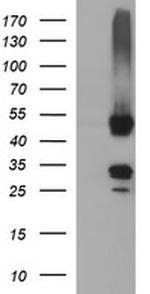 MFAP3 Antibody in Western Blot (WB)