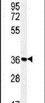 SLC25A28 Antibody in Western Blot (WB)