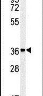 MFSD3 Antibody in Western Blot (WB)
