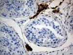 MGARP Antibody in Immunohistochemistry (Paraffin) (IHC (P))