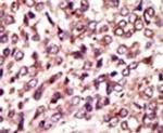 MGAT1 Antibody in Immunohistochemistry (IHC)