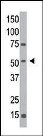 MGAT1 Antibody in Western Blot (WB)