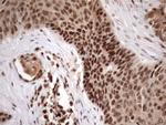 MGC12965 Antibody in Immunohistochemistry (Paraffin) (IHC (P))