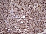 MGC12965 Antibody in Immunohistochemistry (Paraffin) (IHC (P))
