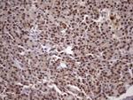 MGC12965 Antibody in Immunohistochemistry (Paraffin) (IHC (P))