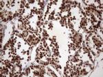 MGC12965 Antibody in Immunohistochemistry (Paraffin) (IHC (P))