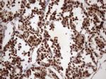 MGC12965 Antibody in Immunohistochemistry (Paraffin) (IHC (P))