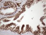 MGC12965 Antibody in Immunohistochemistry (Paraffin) (IHC (P))