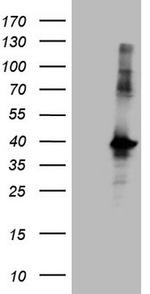 MGC12965 Antibody in Western Blot (WB)