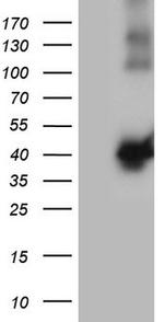 MGC12965 Antibody in Western Blot (WB)