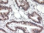 MGLL Antibody in Immunohistochemistry (Paraffin) (IHC (P))