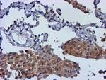 MGLL Antibody in Immunohistochemistry (Paraffin) (IHC (P))